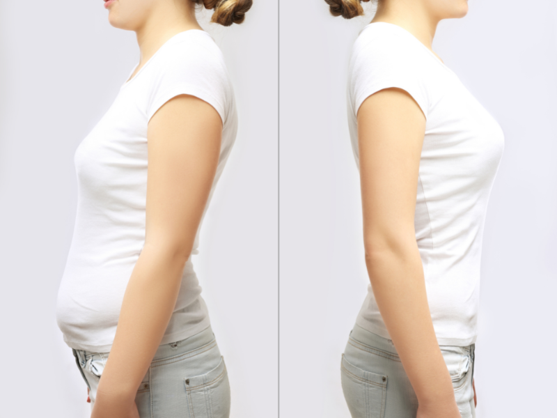 Diastasis recti – ćwiczenia oddechowo-posturalne na brzuch po ciąży